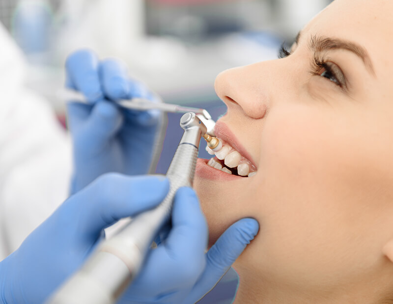 Zahnpolieren in Med-Hun-Dent Zahnklnik